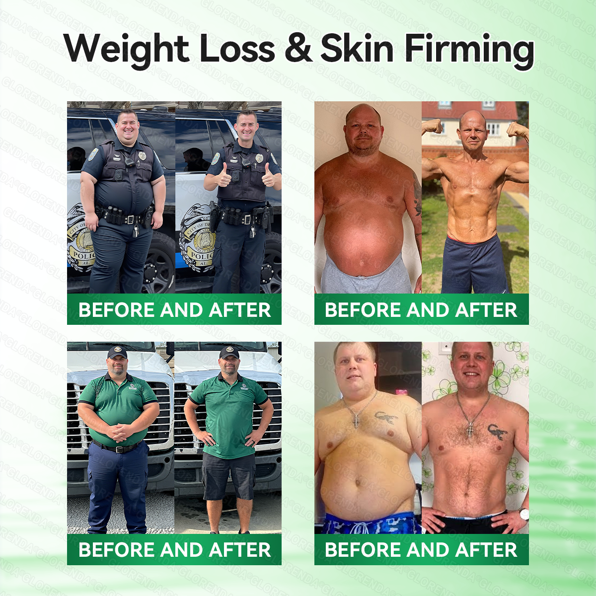 𝐎𝐟𝐟𝐢𝐜𝐢𝐚𝐥 𝐒𝐭𝐨𝐫𝐞 | 𝐆𝐋𝐎𝑹𝑬𝗡𝗗𝗔® 𝑴𝒐𝒓𝒊𝒏𝙜𝙖 · 𝘽𝙚𝙧𝙗𝙚𝙧𝒊𝒏𝒆 × 𝐍𝐴𝑫+ 10-𝐢𝐧-1 𝑨𝒅𝒗𝒂𝒏𝒄𝐞𝐝 𝑵𝒂𝙣𝙤 𝑴𝒊𝒄𝒓𝒐𝒏𝒆𝒆𝗱𝗹𝗲 𝐏𝐚𝒕𝗰𝗵 (𝐉𝐮𝐬𝐭 𝐨𝐧𝐜𝐞 𝐚 𝐝𝐚𝐲, 𝐯𝐢𝐬𝐢𝐛𝐥𝐞 𝐜𝐡𝐚𝐧𝐠𝐞𝐬 𝐢𝐧 𝟕 𝐝𝐚𝐲𝐬) ✅ 𝐅𝐨𝐫 𝐨𝐛𝐞𝒔𝒊𝒕𝒚, 𝐥𝐨𝐨𝐬𝐞 𝐬𝐤𝐢𝐧, 𝐝𝐢𝐚𝐛𝒆𝒕𝒆𝒔, 𝐬𝐥𝐞𝐞𝐩 𝐚𝐩𝐧𝐞𝐚, 𝐣𝐨𝐢𝐧𝐭 𝐢𝐬𝐬𝐮𝐞𝐬, 𝐚𝐧𝐝 𝐦𝐨𝐫𝐞